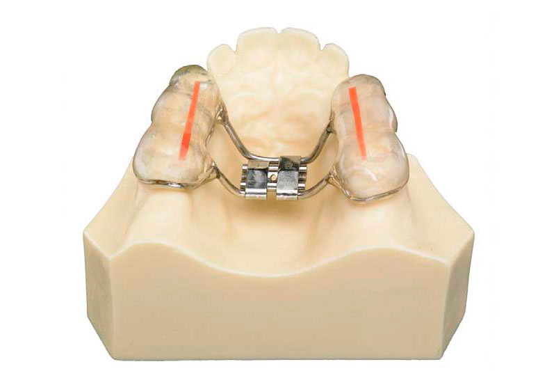 mcnamara guia oclusal